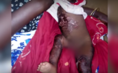 Chemical Weapon Attacks in Darfur – A Case for Conscious Thinking